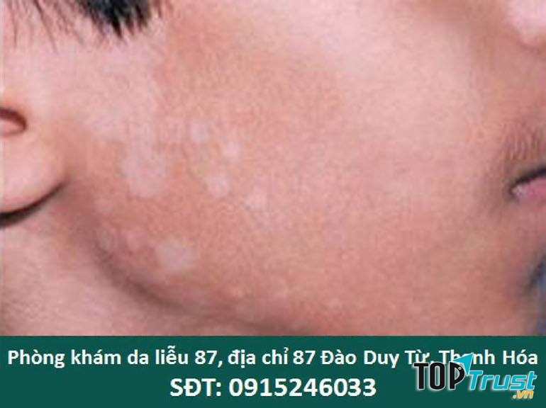 Phòng Khám Da Liễu 87 - Thanh Hóa