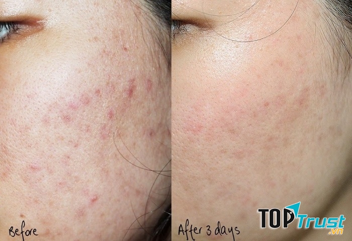 Phòng khám da liễu BS Lê Bá Rạng