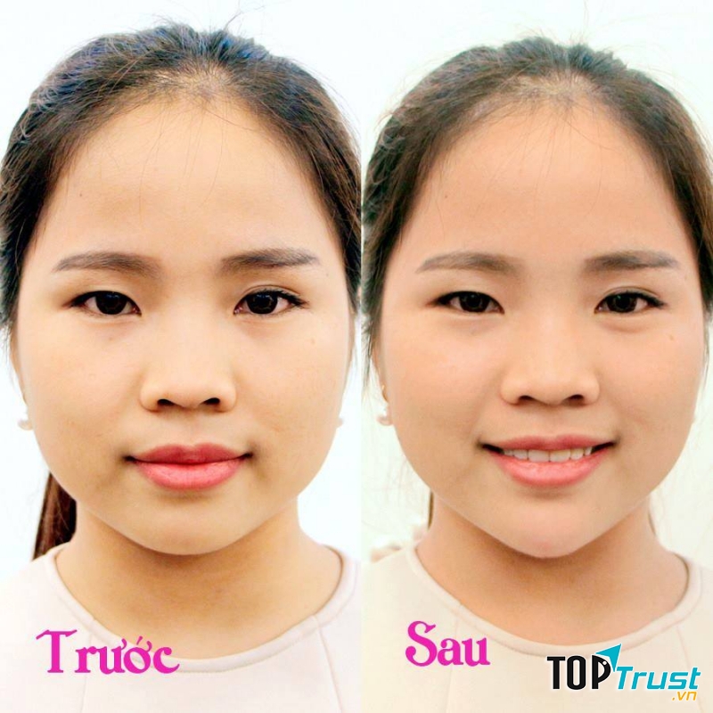 Phòng khám Da liễu - BS. Nguyễn Đắc Dụng