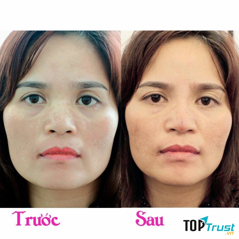 Phòng khám Da liễu - BS. Nguyễn Đắc Dụng