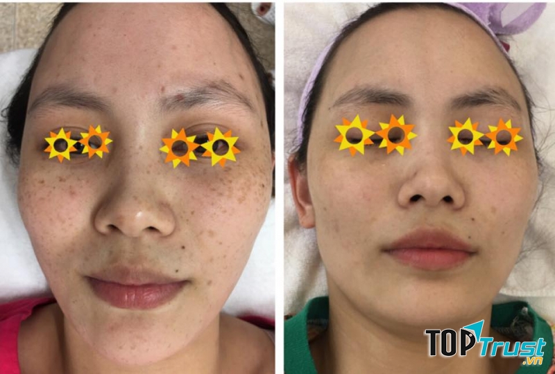 Phòng khám Da liễu - BS.CKI. Nguyễn Thị Thu Thủy