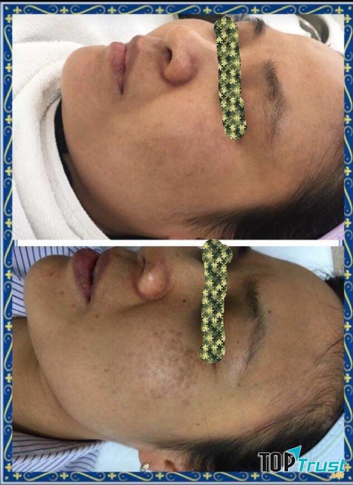 Phòng khám Da liễu - BS.CKI. Nguyễn Thị Thu Thủy