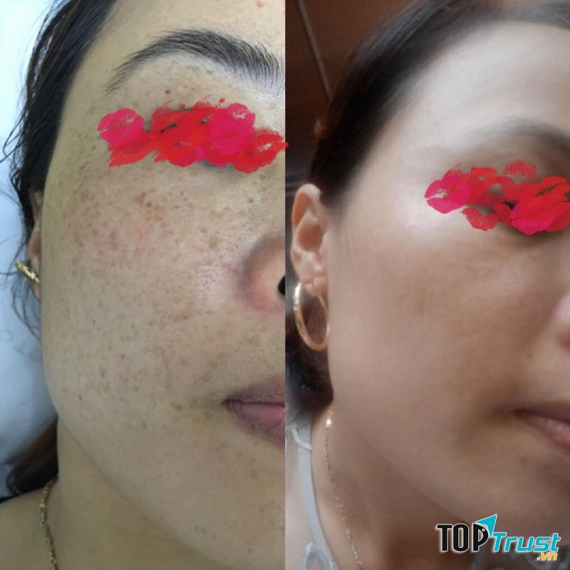 Phòng Khám Da Liễu Bs.phương