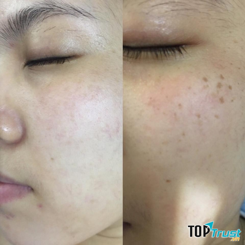 Phòng khám da liễu - Laser thẫm mỹ