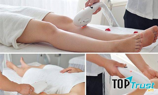 Phòng khám da liễu - Laser thẫm mỹ