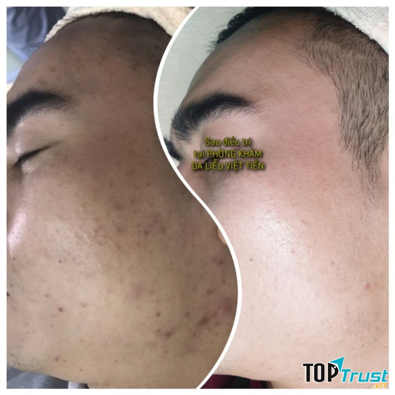 Phòng khám da liễu Việt Tiến