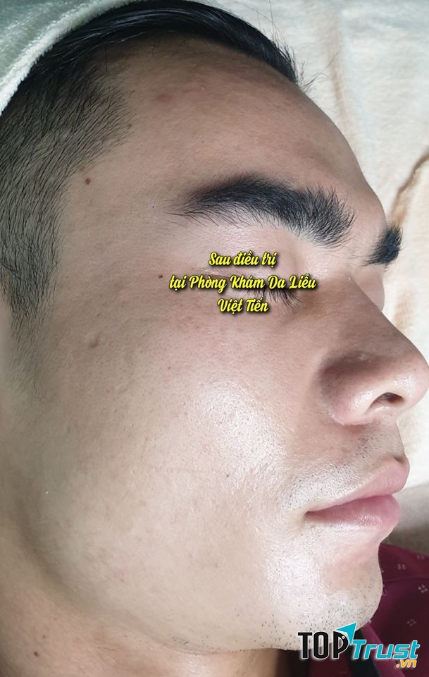 Phòng khám da liễu Việt Tiến