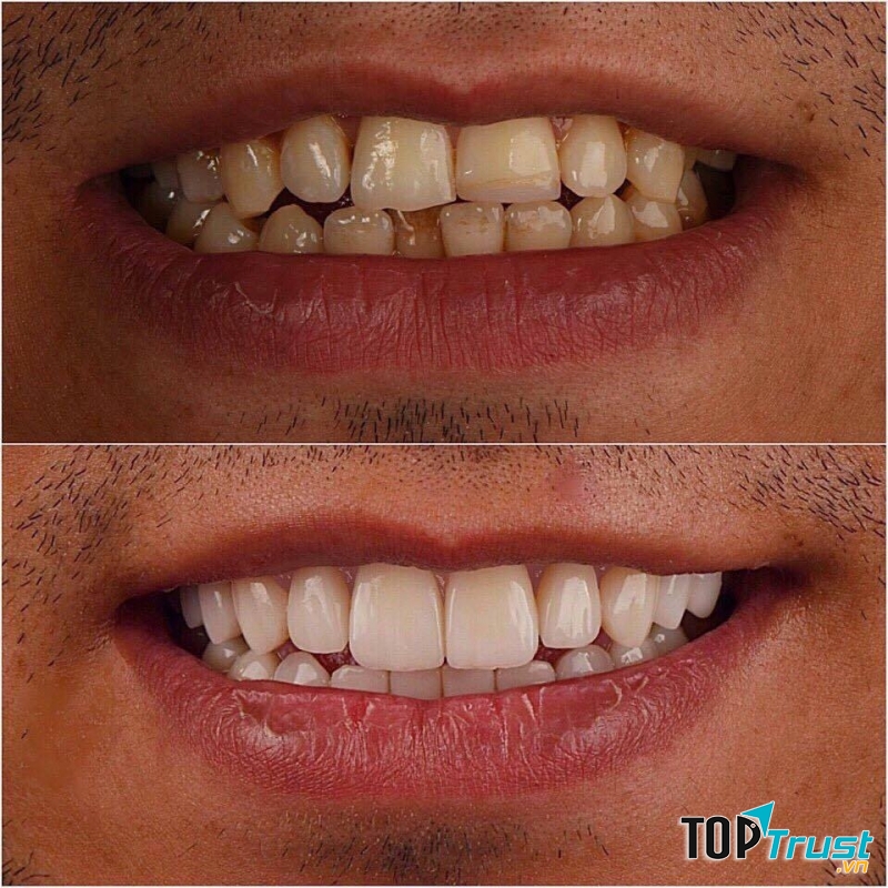 Phòng khám nha khoa Hà Nội