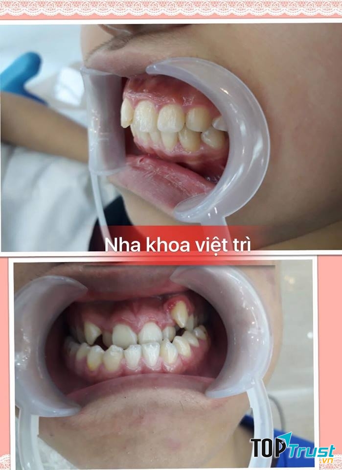 Phòng khám Nha Khoa Việt Trì - B/s Hưng