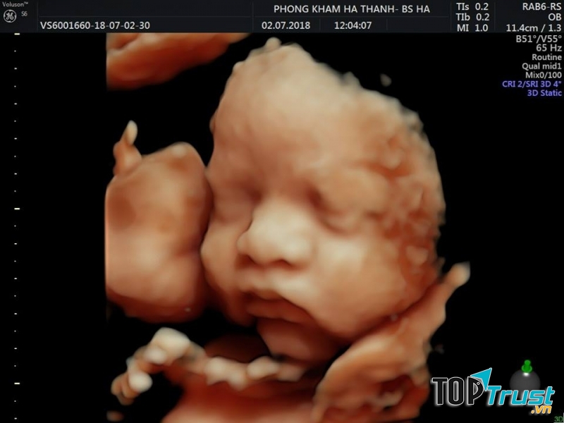 Phòng Khám Phụ Sản Hà Thành-54 Phan Bá Vành-Thành Phố Thái Bình