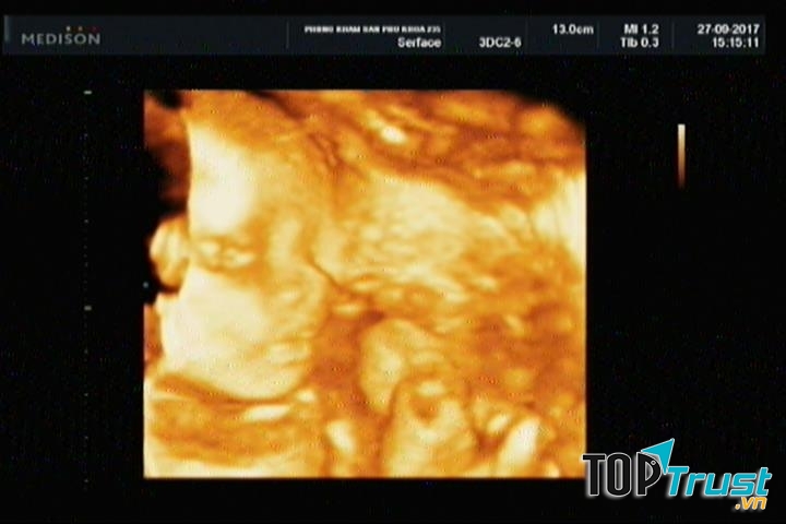 Phòng Khám Sản Phụ Khoa 235 - 235 Lê Đại Hành - TP. Thái Bình