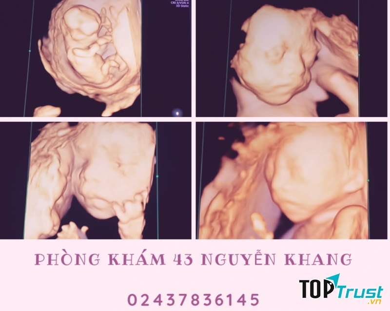 Phòng Khám Sản phụ khoa 43 Nguyễn Khang