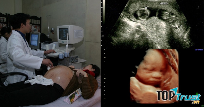 Ảnh minh họa - Nguồn Internet