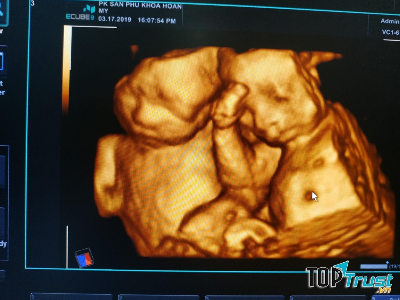 Phòng Khám Sản Phụ Khoa Hoàn Mỹ