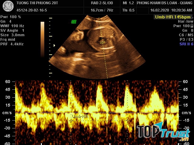 Phòng khám Sản phụ khoa Loan Quang