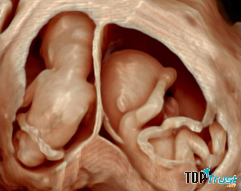 Phòng khám,  siêu âm thai 5D Hà Tấn Ngọc