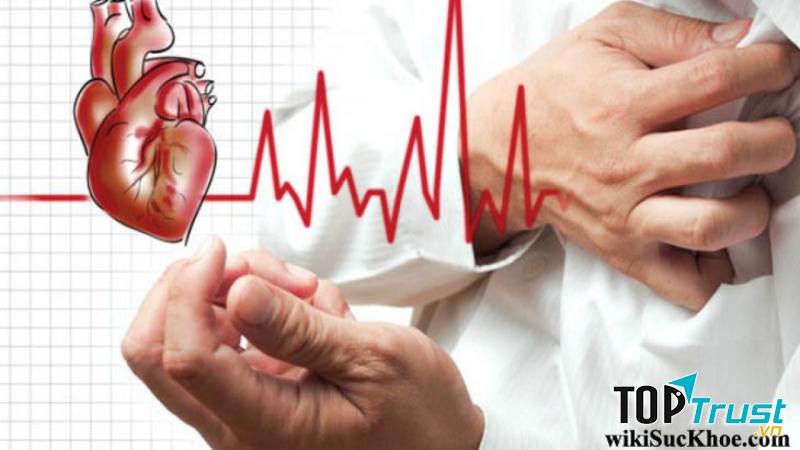 Phòng ngừa các bệnh tim mạch