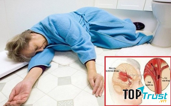 Phòng ngừa cục máu đông