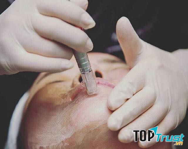 Phun thêu Anh Hoài 2