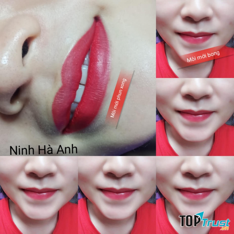 Môi mới phun và sau bong tại phun thêu Ninh Hà Anh