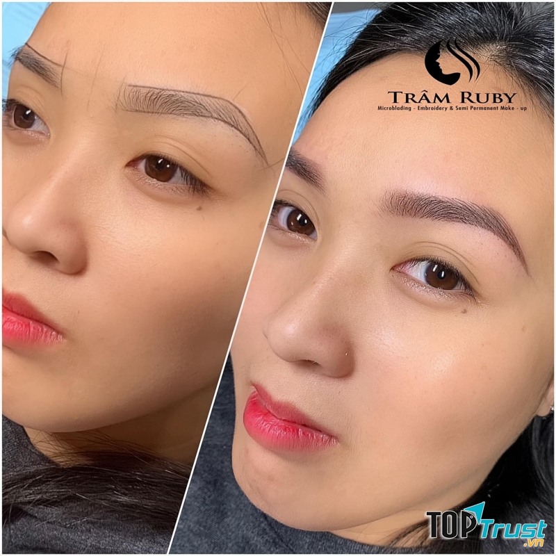 Phun Thêu Trâm Ruby