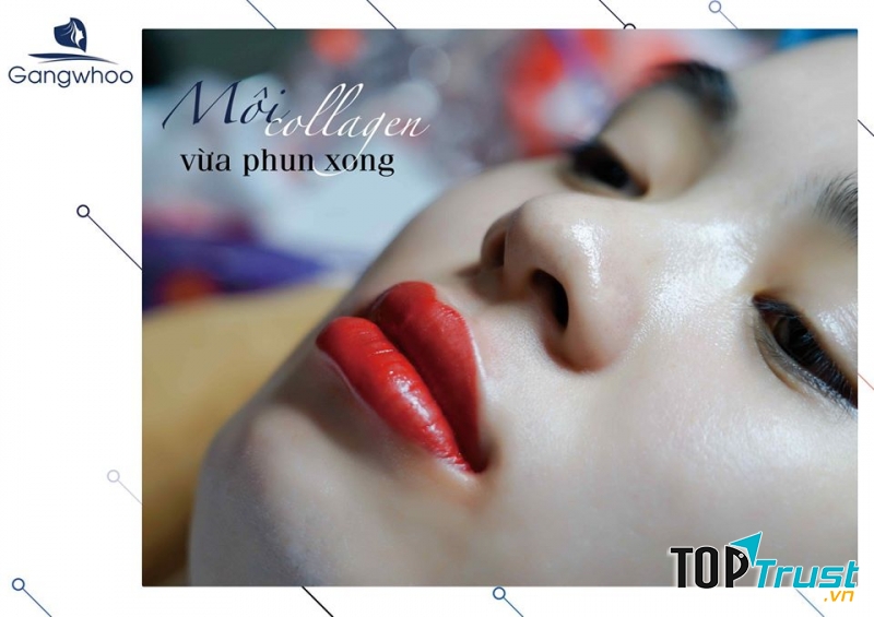 Thẩm Mỹ Gangwhoo