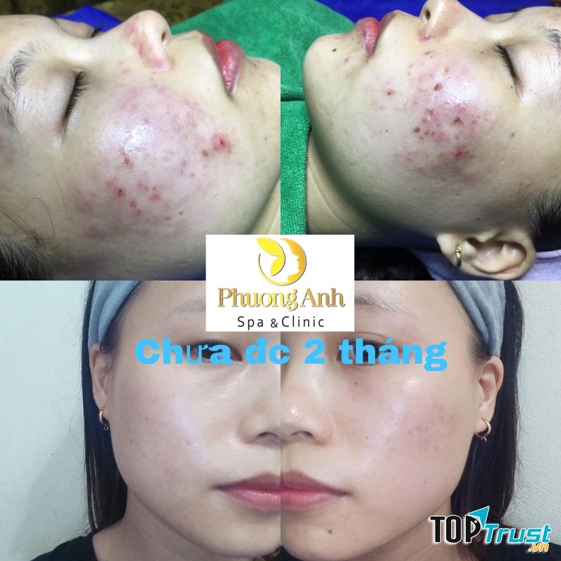Phương Anh Spa & Clinic