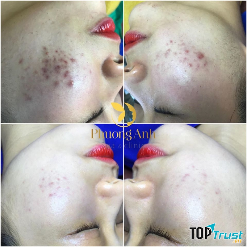 Phương Anh Spa Clinic