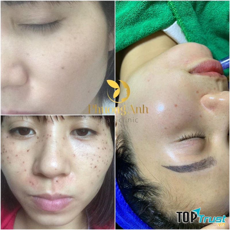 Phương Anh Spa Clinic