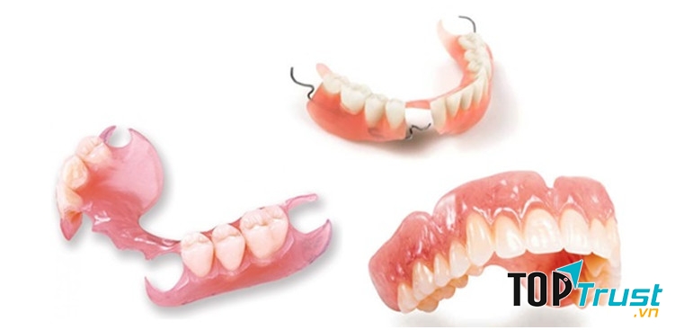 Các loại hàm giả tháo lắp