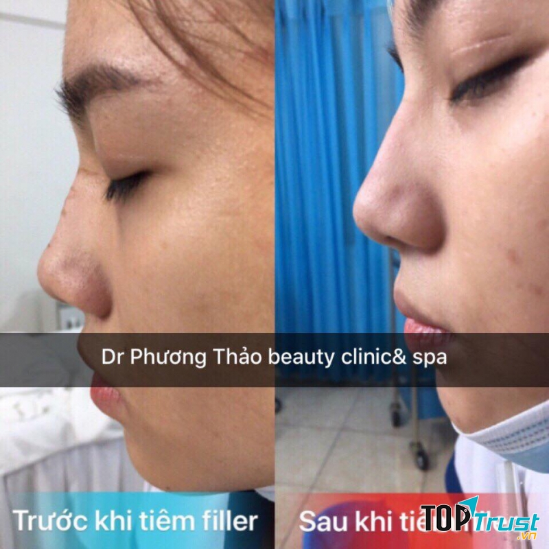 Phương Thảo beauty spa