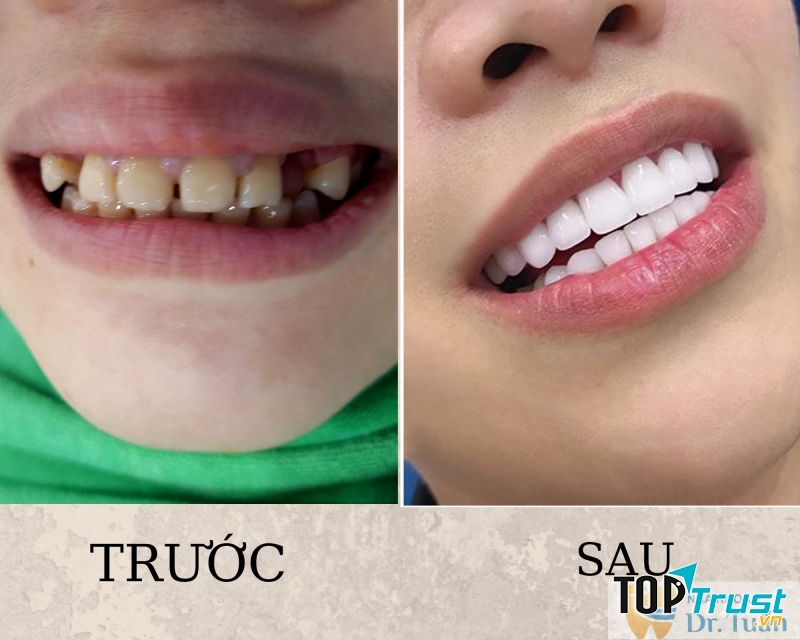 PK Nha Khoa BS Tuấn Nhà Thờ