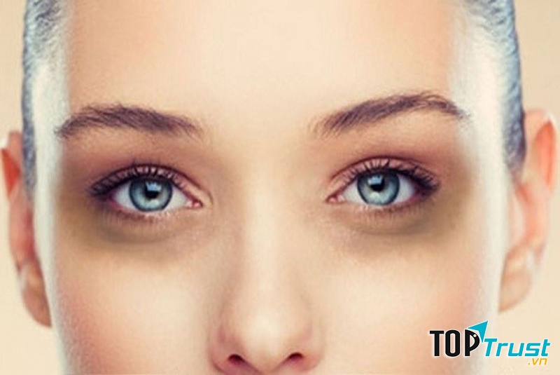 Đây cũng là dấu hiệu báo trước cho bạn một sức khỏe không bình thường mà bạn cần khắc phục.