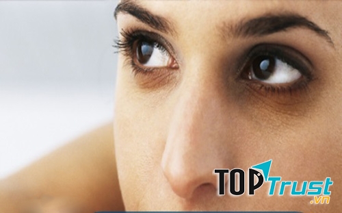 Quầng thâm hình tròn dưới mắt