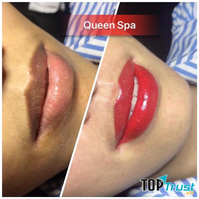 Queen Spa