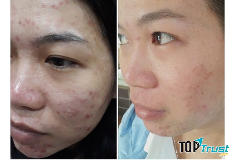 QUEEN SPA LAI THIEU