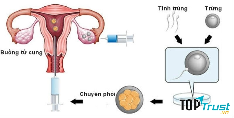 Sơ đồ mô tả quá trình thực hiện phương pháp TTON