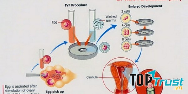 Quy trình thụ tinh ống nghiệm