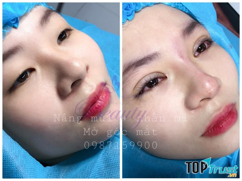 Bác sỹ Quỳnh Anh