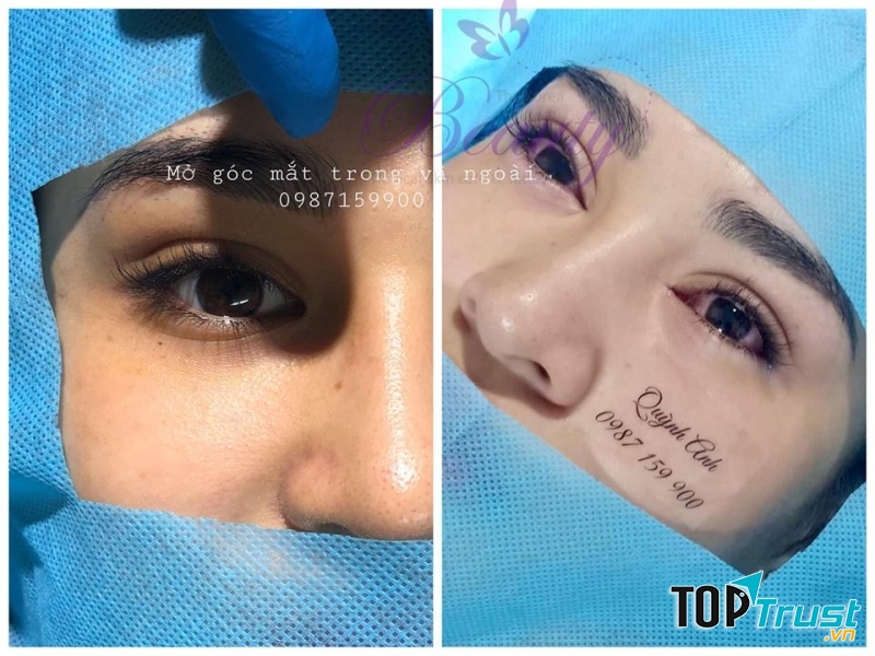 Bác sỹ Quỳnh Anh