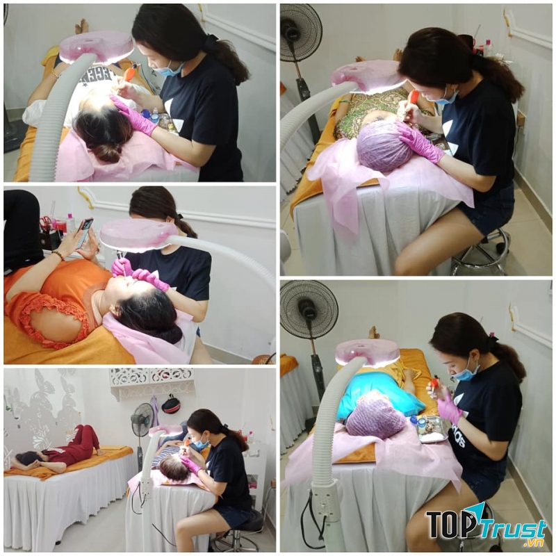 Điều trị mụn tại Quỳnh Anh Spa là