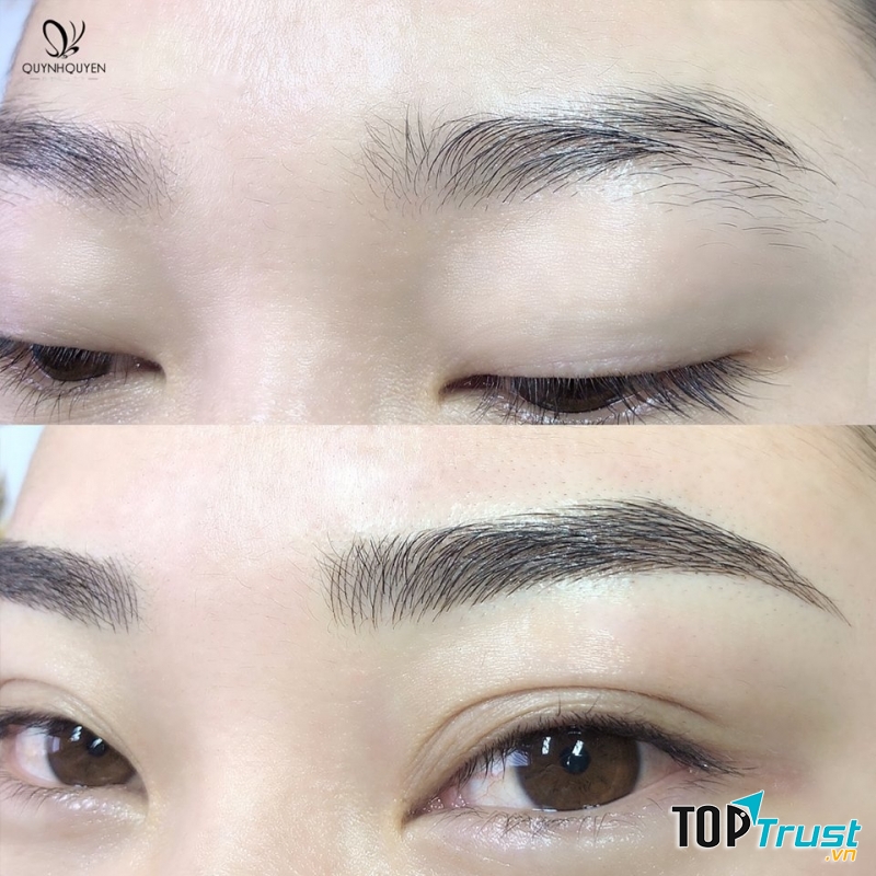 QuynhQuyen Beauty Center