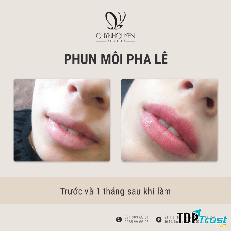 QuynhQuyen Beauty Center