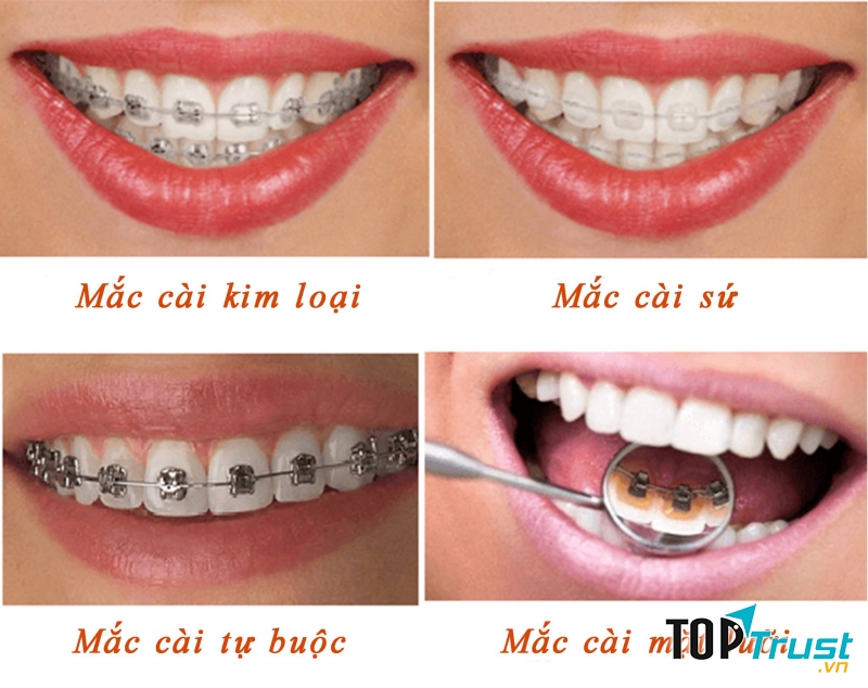 Răng hàm mặt Thái Thượng Hoàng