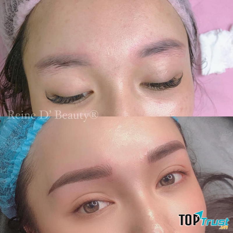 Reine De Beauty Spa Hạ Long - Số 1 công nghệ làm đẹp chuẩn Châu Âu