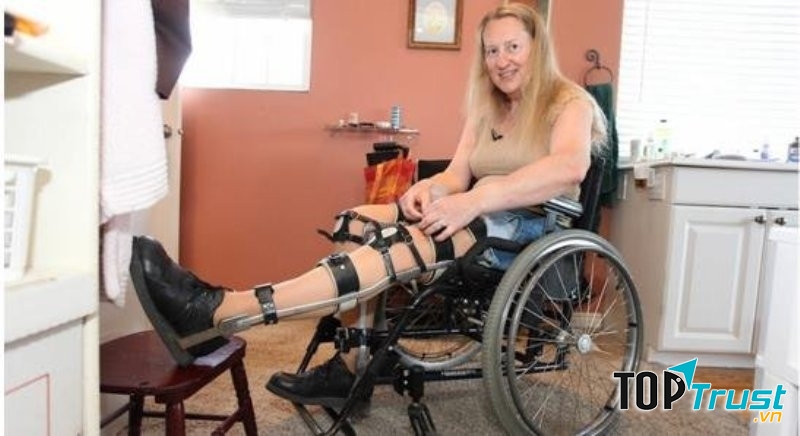 Rối loạn nhận dạng toàn diện cơ thể