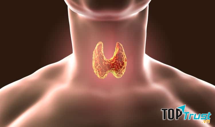 Những người mắc bệnh về tuyến giáp  mái tóc cũng sẽ bị bạc sớm nhanh hơn