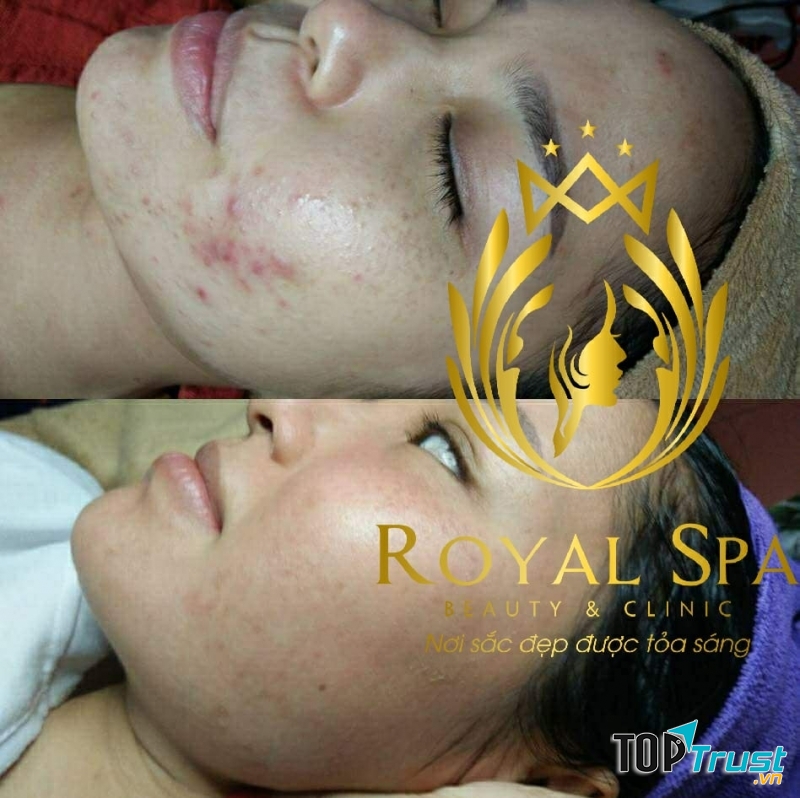 Royal Spa - Beauty & Clinic