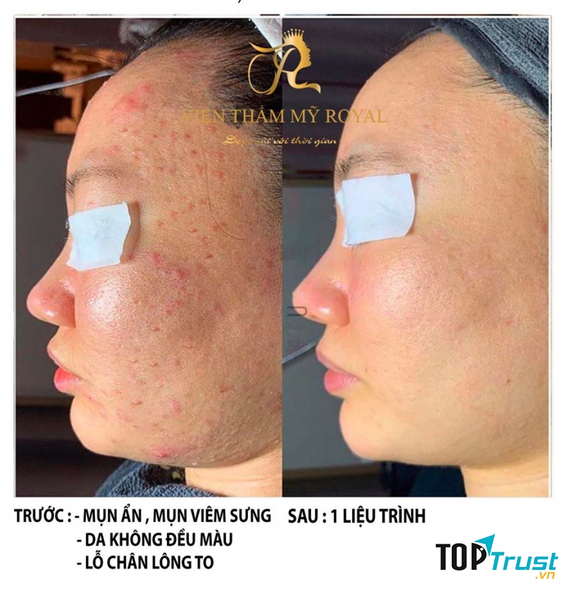 Royal Spa Hải Phòng