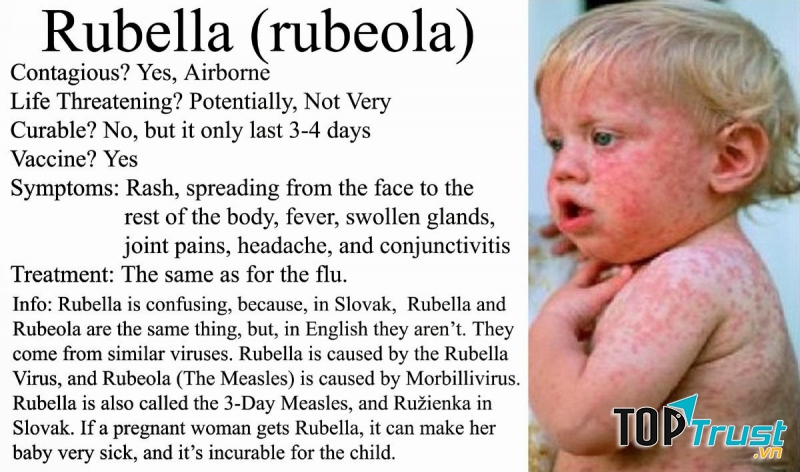 Rubella ở trẻ nhỏ